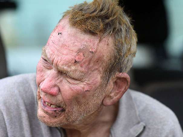 A 82-year-old dog owner burned his face while trying to rescue his dog from a burning animal shelter 
