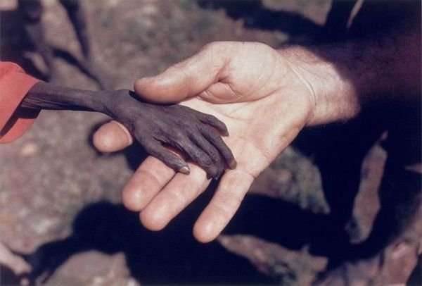 Hand of a starving boy in Uganda