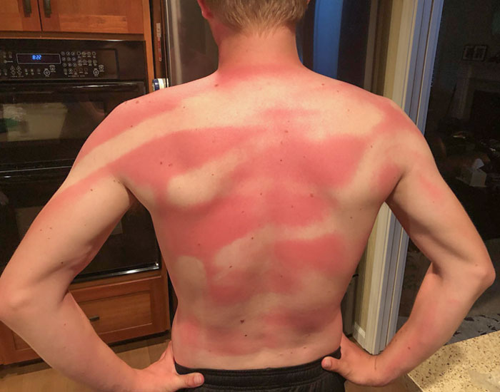 My Wife Helped me Sunscreen my Back at Beach Day Today.